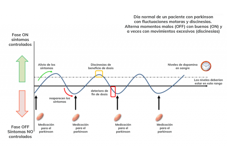p-rkinson-avanzado-aduo-parkinson